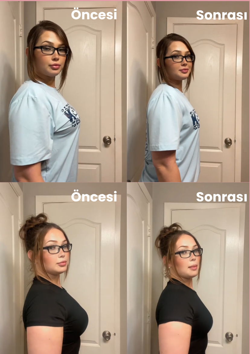 Almirana Göğüs Süzen Sütyen