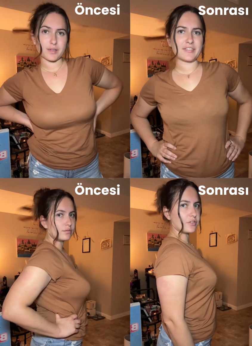 Almirana Göğüs Süzen Sütyen